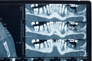 CBCT Imaging Services for Dentists