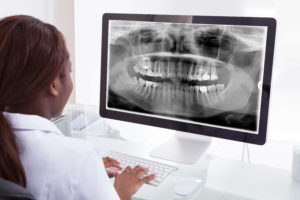 Dentist Looking at Dental X-Ray Imaging