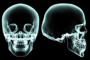 X-Ray of the Teeth and Jaw for Dentist